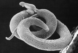Schistosoma Mansoni (Foto: Wikimedia Commons)