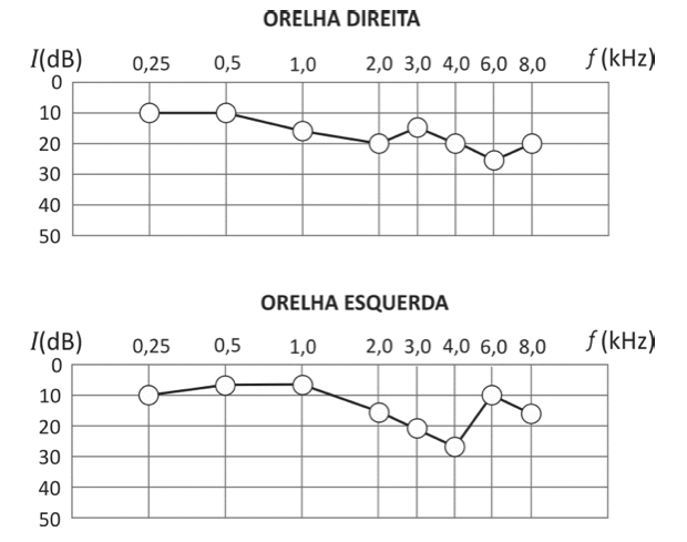Gráfico com níveis de audição (Foto: Reprodução/Fuvest)